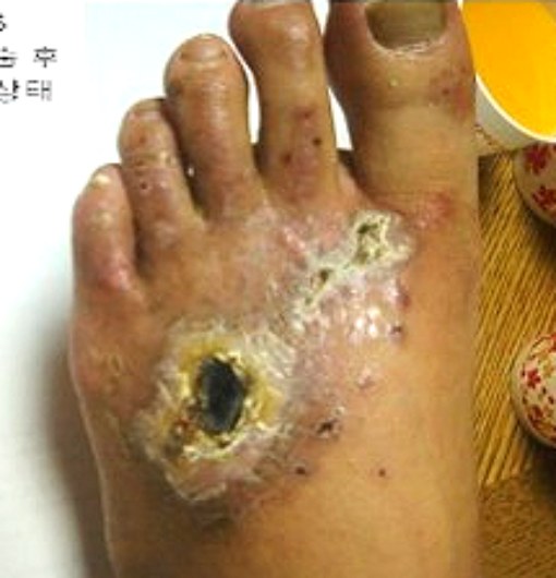 임상 사례 A-1