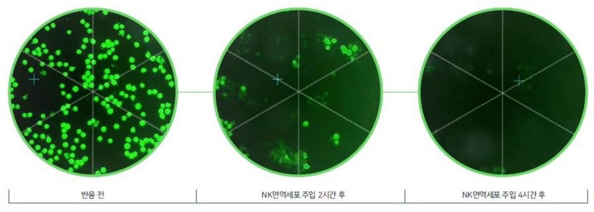 NK면역세포 반응 관찰